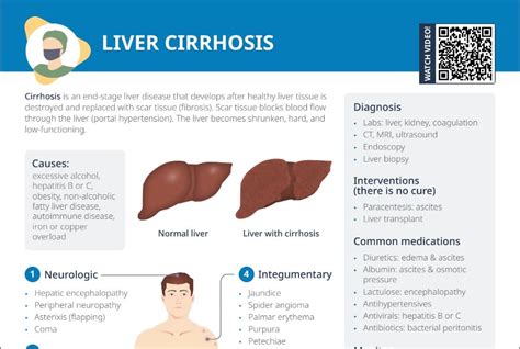 liverosis|Cirrhosis